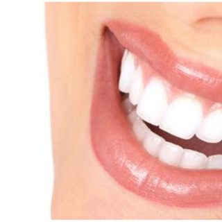 أسعار ابتسامة هوليود