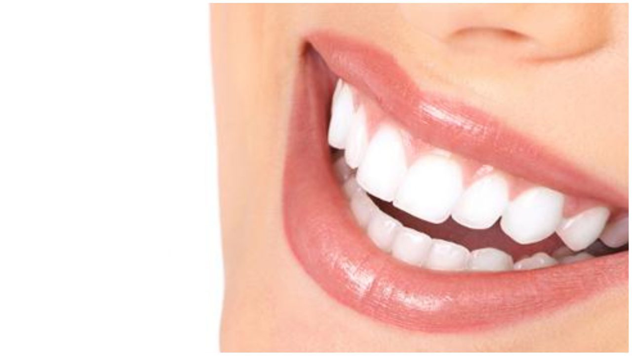 أسعار ابتسامة هوليود