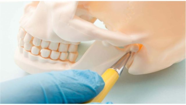 زراعة عظم الفك