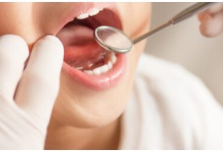 خلع الضرس عند الاطفال