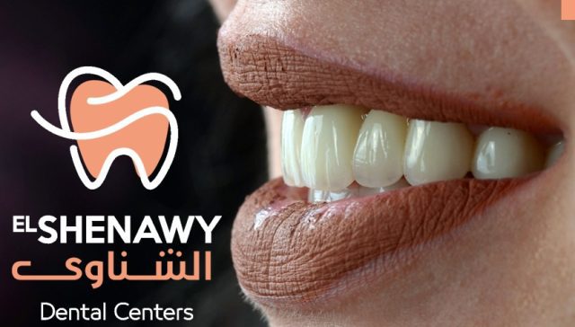 أفضل مركز تجميل أسنان