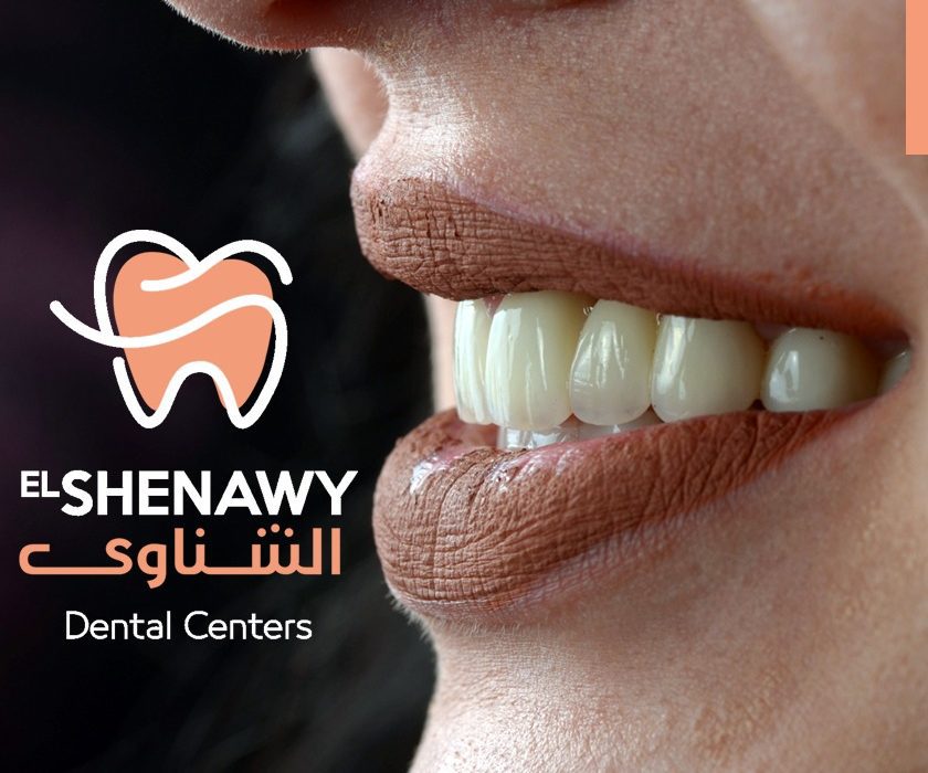أفضل مركز تجميل أسنان
