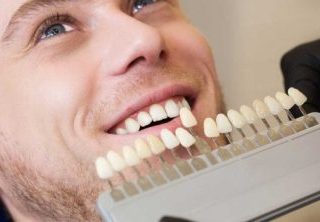 عدسات تجميلية للأسنان