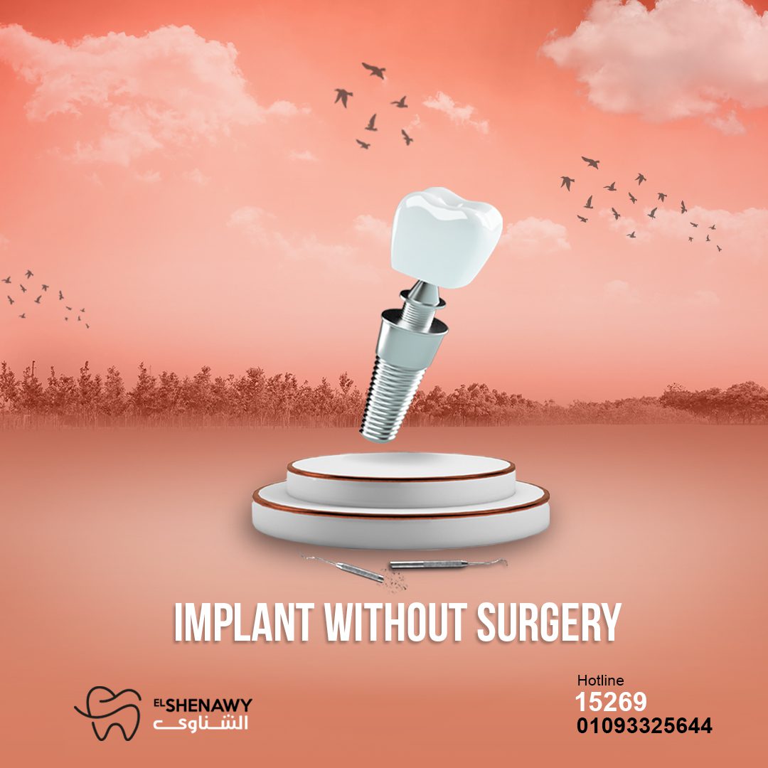 افضل مركز زراعة اسنان