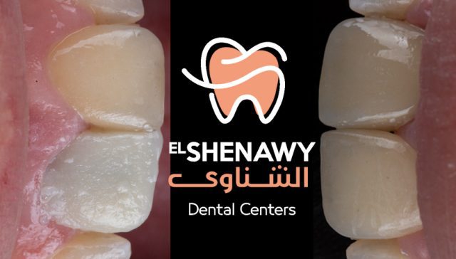 خدمات الشناوي