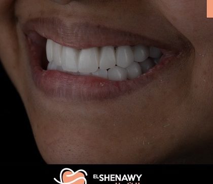 افضل دكتور تجميل اسنان