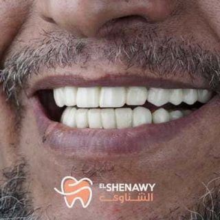 افضل عيادة اسنان في العباسية