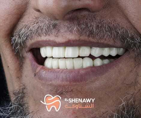 افضل عيادة اسنان في العباسية