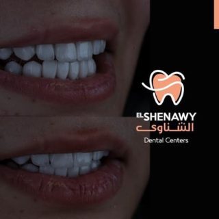 افضل دكتور تجميل اسنان في مصر
