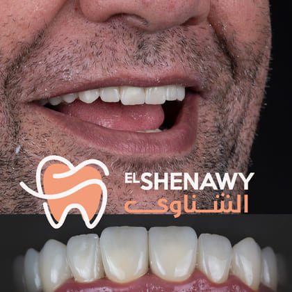 أفضل طرق تجميل الاسنان