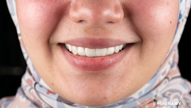 من يحتاج الي الفحص الدوري للاسنان؟