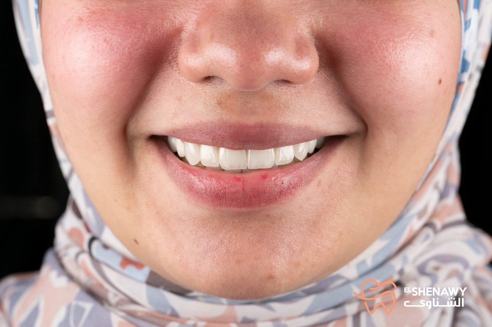 من يحتاج الي الفحص الدوري للاسنان؟