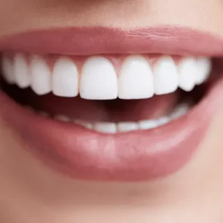 كيف أحسن شكل أسناني؟