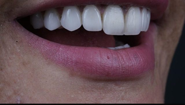 best cosmetic dentistry center