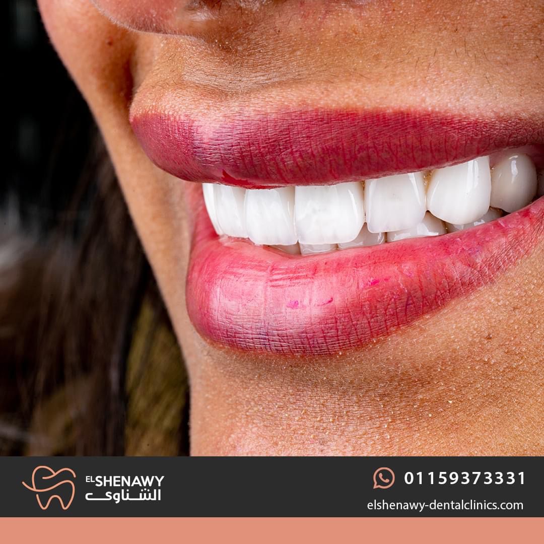 The best dental clinic in Egypt
