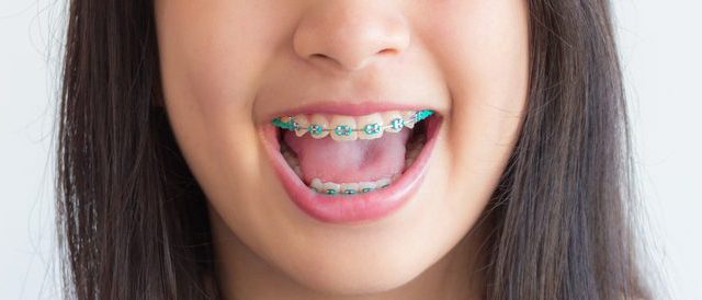 the price of orthodontics