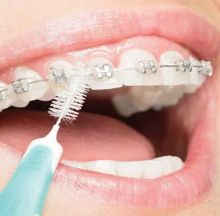 أسباب سقوط قواعد التقويم