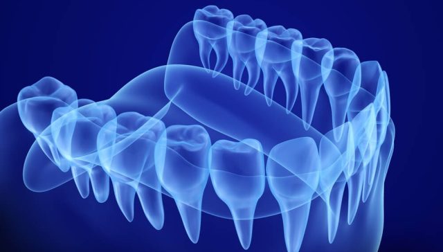 3D Dental Scan