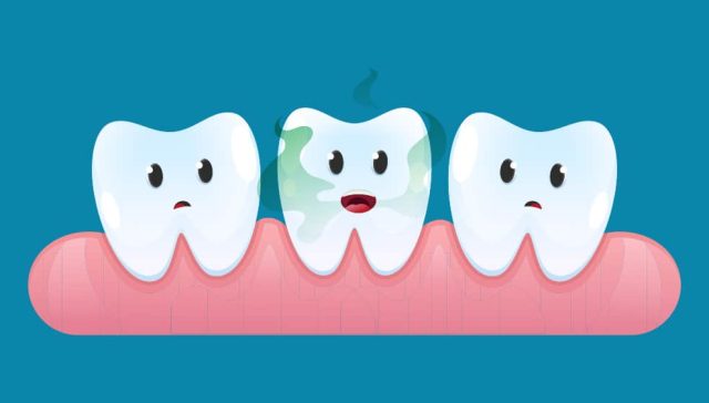 Causes of Bad Breath