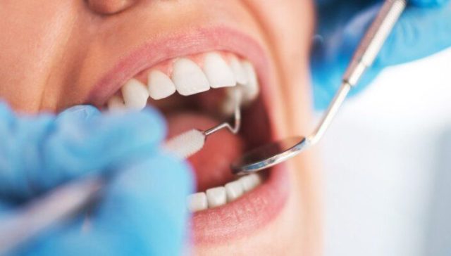 dental care during pregnancy