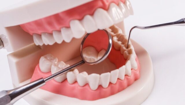 preventive dental care