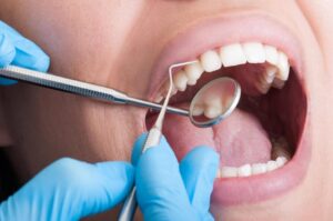tooth sensitivity treatment