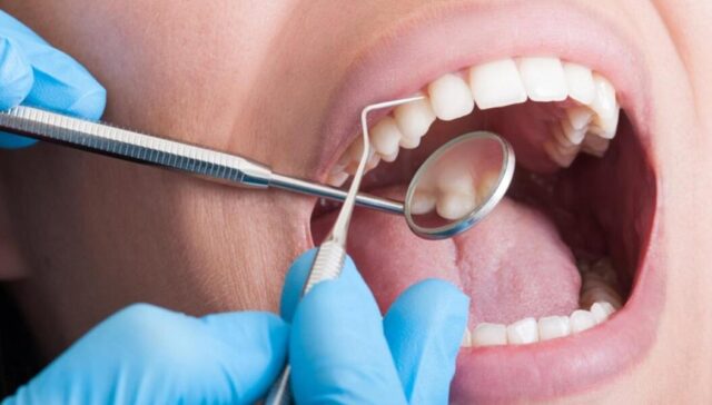 tooth sensitivity treatment