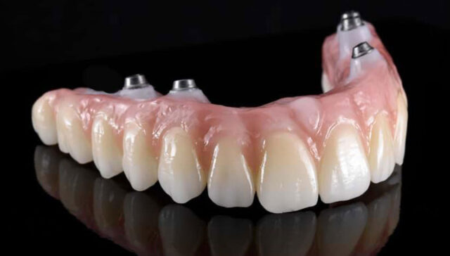 Zirconia Dental Prosthesis