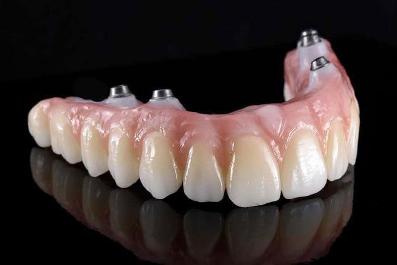 Zirconia Dental Prosthesis