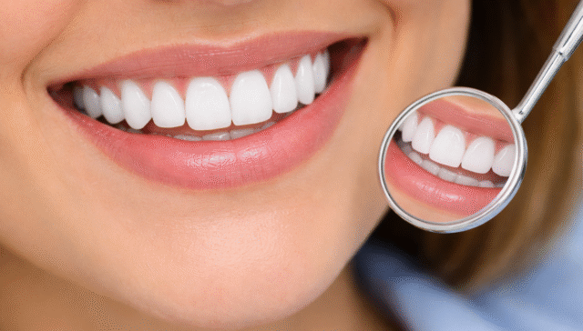 Smile Perfectly Best Veneers Dentist for Natural Look in Egypt