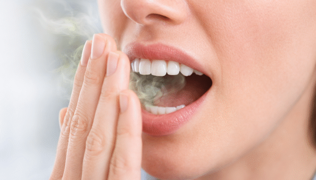 كيف تتخلص من رائحة الفم الكريهة ومتى تحتاج لزيارة طبيب؟