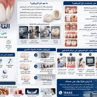 التاج الزيركون: متى يُستخدم وكم يدوم؟