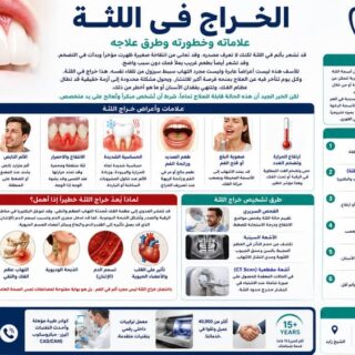 الخراج في اللثة: علاماته وخطورته وطرق علاجه