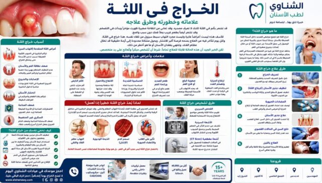 الخراج في اللثة: علاماته وخطورته وطرق علاجه